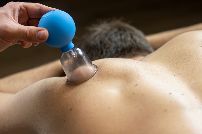 Entgiftende Schröpf Massage zur Stimulierung der Durchblutung mit Sauggläsern auf der Haut